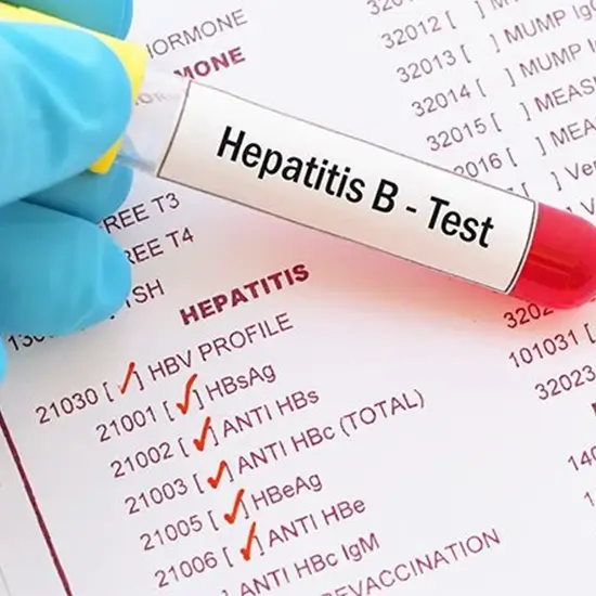 Hepatitis B Core Antibody, Total Quantitative